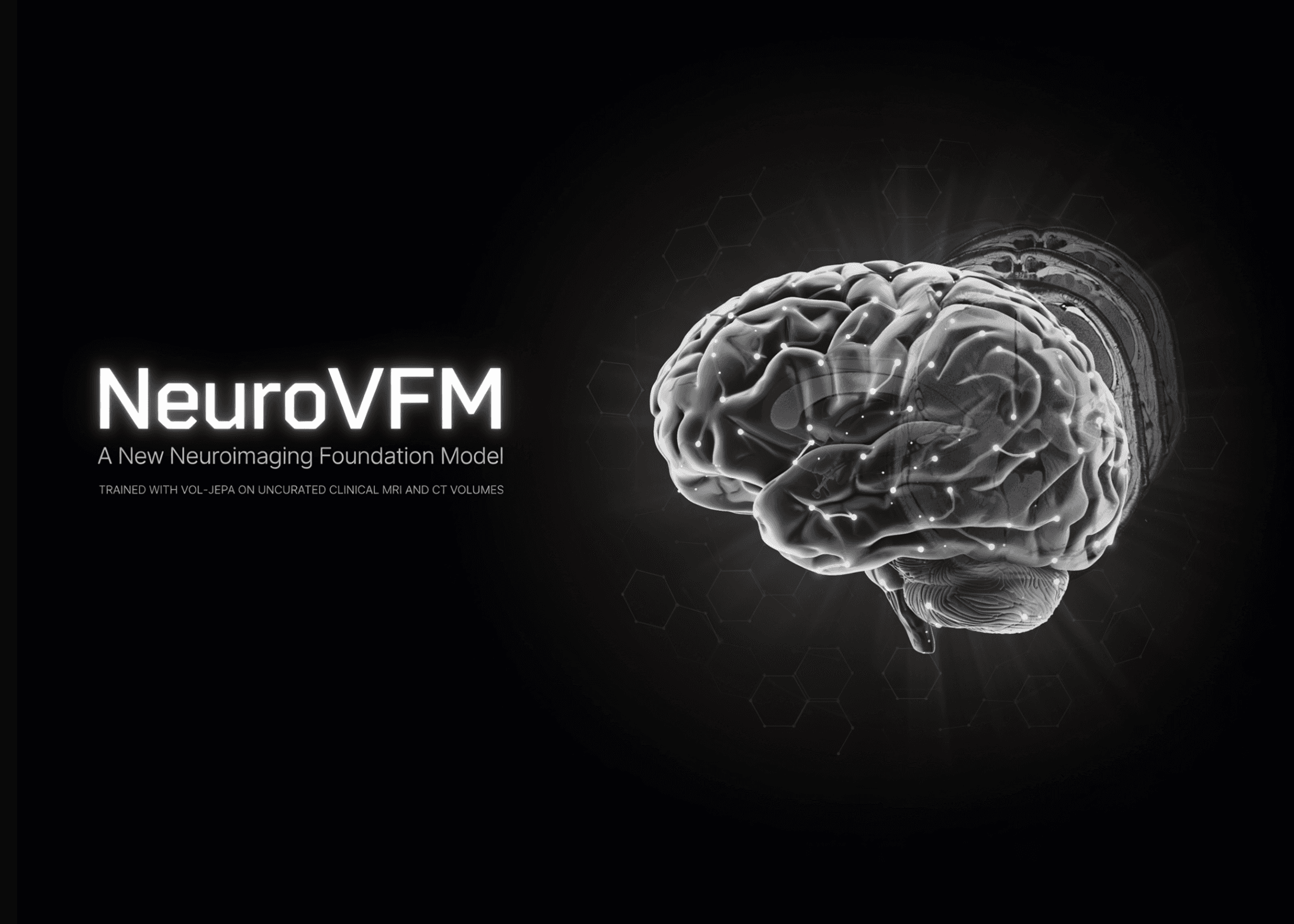 NeuroVFM: Nowy model fundamentowy dla neuroobrazowania uczy się anatomii mózgu z nieoznakowanych danych klinicznych